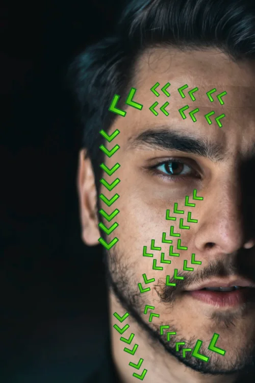 Close-up of a man’s face with green arrows showing gua sha stroke directions to reduce face bloating.