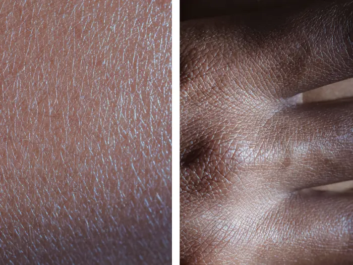Close-up comparison of dry skin texture for a skincare routine for men.