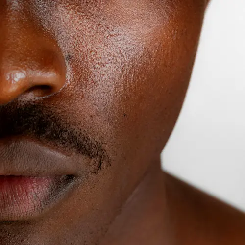 Close-up of a man with oily facial skin as part of a skincare routine for men.